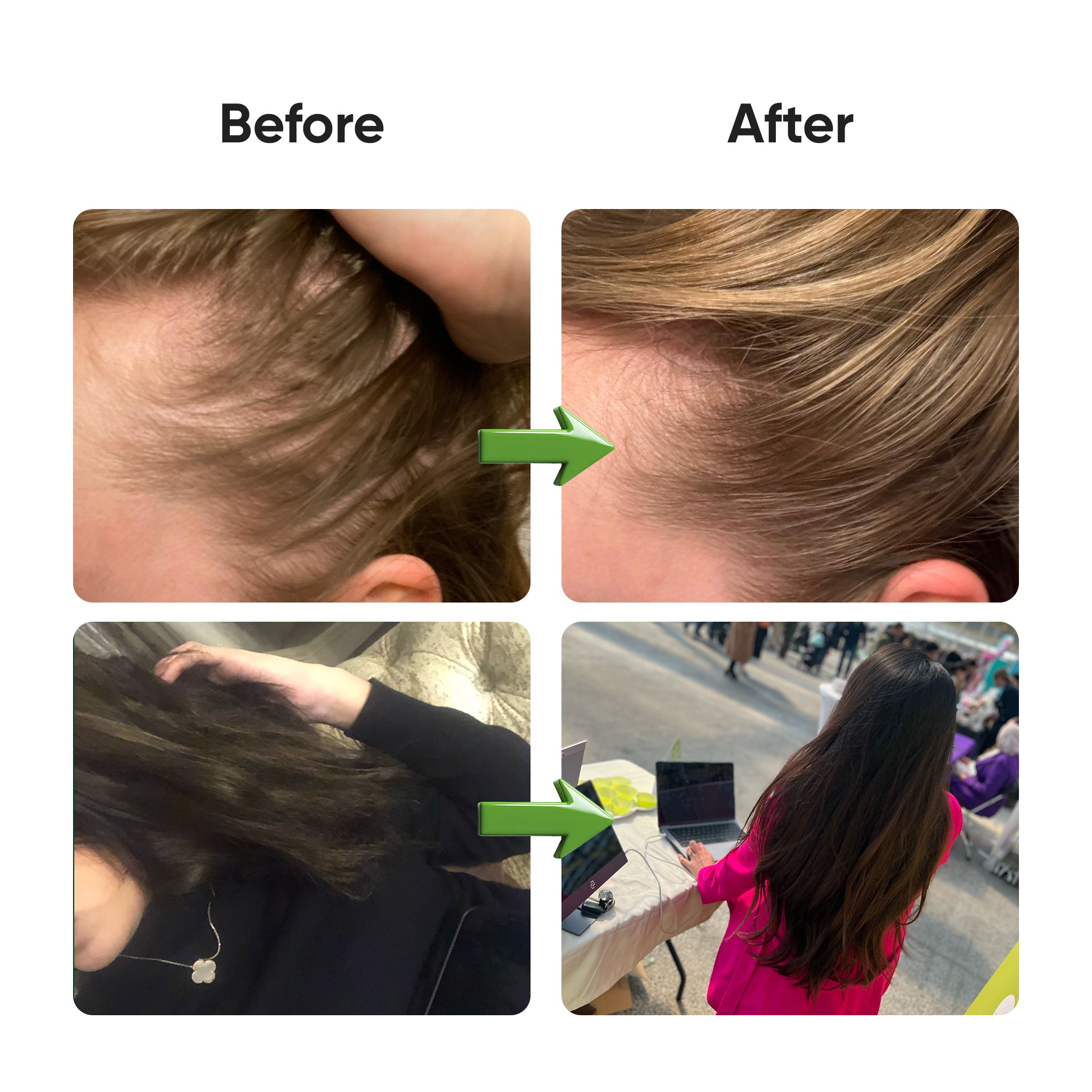 Veganboost Hair Vitamins - Watermelon