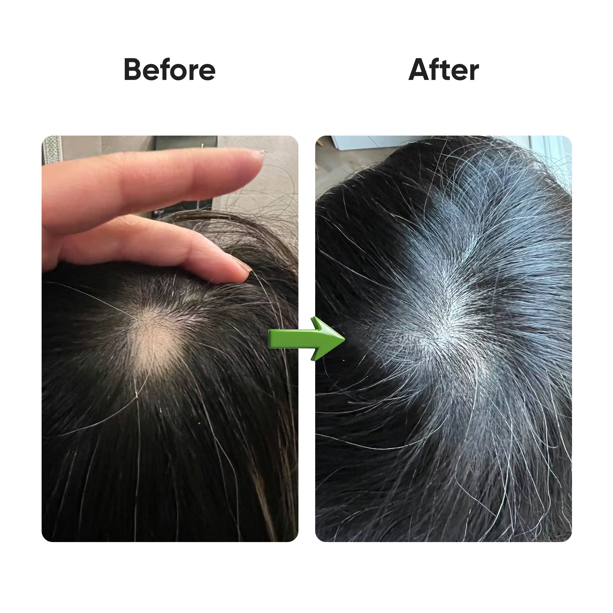 Scalp Serum